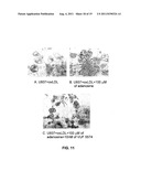 METHODS OF TREATING ATHEROSCLEROSIS diagram and image