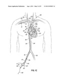 METHODS OF SECURING A CANNULA ASSEMBLY, IMPLANTING A CIRCULATORY ASSIST     SYSTEM AND CROSSING A TISSUE BARRIER diagram and image