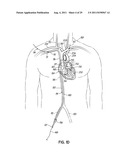 METHODS OF SECURING A CANNULA ASSEMBLY, IMPLANTING A CIRCULATORY ASSIST     SYSTEM AND CROSSING A TISSUE BARRIER diagram and image