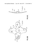 METHODS OF SECURING A CANNULA ASSEMBLY, IMPLANTING A CIRCULATORY ASSIST     SYSTEM AND CROSSING A TISSUE BARRIER diagram and image