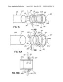 METHODS OF SECURING A CANNULA ASSEMBLY, IMPLANTING A CIRCULATORY ASSIST     SYSTEM AND CROSSING A TISSUE BARRIER diagram and image