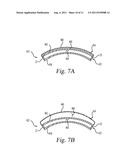 SURGICAL RETRACTOR INSTRUMENT SYSTEMS AND METHODS OF USING THE SAME diagram and image