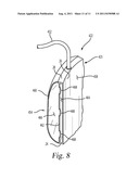 SURGICAL RETRACTOR INSTRUMENT SYSTEMS AND METHODS OF USING THE SAME diagram and image