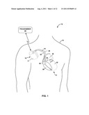 OPTICAL SENSOR FOR MEDICAL DEVICE diagram and image