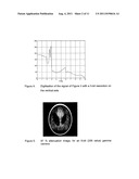 CODED APERTURE MASKS FOR RADIATION-BASED MEDICAL IMAGING diagram and image