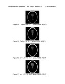 CODED APERTURE MASKS FOR RADIATION-BASED MEDICAL IMAGING diagram and image