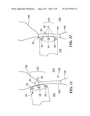 OPTICAL SYSTEM AND METHOD FOR LOCALIZING THE FOSSA OVALIS DURING     TRANS-SEPTAL PROCEDURES diagram and image