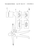 METHOD AND APPARATUS FOR QUANTIFICATION OF CARDIAC WALL MOTION ASYNCHRONY diagram and image