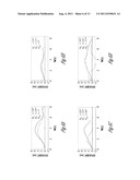 METHOD AND APPARATUS FOR QUANTIFICATION OF CARDIAC WALL MOTION ASYNCHRONY diagram and image