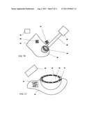 MEDICAL MEASURING SYSTEM, METHOD FOR SURGICAL INTERVENTION AS WELL AS USE     OF A MEDICAL MEASURING SYSTEM diagram and image