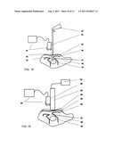 MEDICAL MEASURING SYSTEM, METHOD FOR SURGICAL INTERVENTION AS WELL AS USE     OF A MEDICAL MEASURING SYSTEM diagram and image