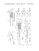 POSITIONING DEVICE FOR OSTIAL LESIONS diagram and image