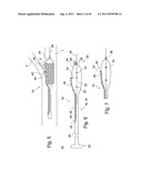 POSITIONING DEVICE FOR OSTIAL LESIONS diagram and image