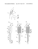 POSITIONING DEVICE FOR OSTIAL LESIONS diagram and image