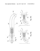 POSITIONING DEVICE FOR OSTIAL LESIONS diagram and image