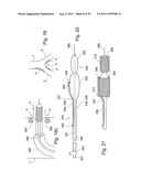 POSITIONING DEVICE FOR OSTIAL LESIONS diagram and image