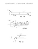 POSITIONING DEVICE FOR OSTIAL LESIONS diagram and image