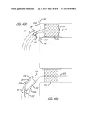 POSITIONING DEVICE FOR OSTIAL LESIONS diagram and image