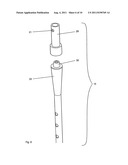 IMPLANT, IN PARTICULAR INTRAMEDULLARY PIN FOR TREATING A PROXIMAL FRACTURE     OF THE HUMERUS diagram and image