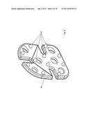 IMPLANT, IN PARTICULAR INTRAMEDULLARY PIN FOR TREATING A PROXIMAL FRACTURE     OF THE HUMERUS diagram and image