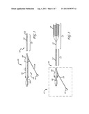 METHOD OF RESTORING BLOOD FLOW THROUGH AN OBSTRUCTED BLOOD VESSEL OF THE     BRAIN diagram and image