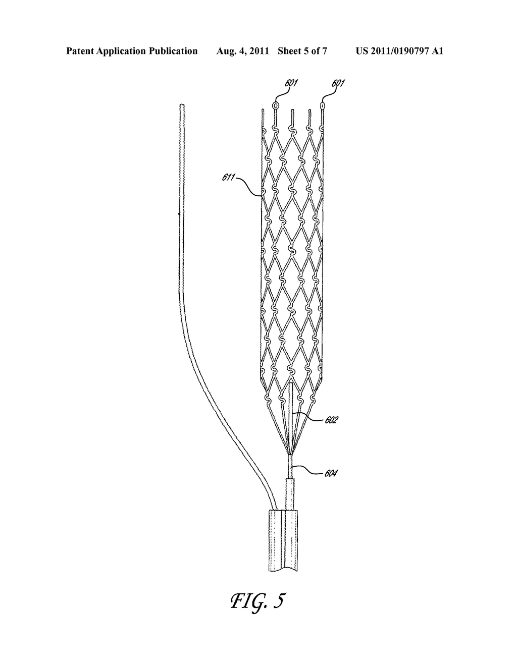 METHOD OF RESTORING BLOOD FLOW THROUGH AN OBSTRUCTED BLOOD VESSEL OF THE     BRAIN - diagram, schematic, and image 06
