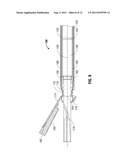 ULTRASONIC TRANSDUCER SYSTEM diagram and image