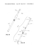 Internal Structure Stabilization System for Spanning Three or More     Structures diagram and image