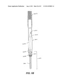 Internal Structure Stabilization System for Spanning Three or More     Structures diagram and image