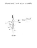 Internal Structure Stabilization System for Spanning Three or More     Structures diagram and image