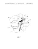 SYSTEM AND METHOD FOR STABILIZING A POSTERIOR FUSION OVER MOTION SEGMENTS diagram and image