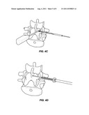 SYSTEM AND METHOD FOR STABILIZING A POSTERIOR FUSION OVER MOTION SEGMENTS diagram and image