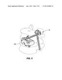 SYSTEM AND METHOD FOR STABILIZING A POSTERIOR FUSION OVER MOTION SEGMENTS diagram and image