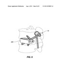 SYSTEM AND METHOD FOR STABILIZING A POSTERIOR FUSION OVER MOTION SEGMENTS diagram and image