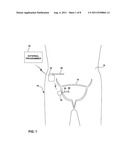 TRANSMEMBRANE SENSING DEVICE FOR SENSING BLADDER CONDITION diagram and image