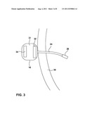 TRANSMEMBRANE SENSING DEVICE FOR SENSING BLADDER CONDITION diagram and image