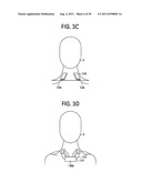 PORTABLE NEGATIVE PRESSURE VENTILATION DEVICE AND METHODS AND SOFTWARE     RELATED THERETO diagram and image