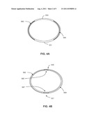 LEAD HAVING EXPANDABLE DISTAL PORTION diagram and image