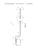 LEAD HAVING EXPANDABLE DISTAL PORTION diagram and image