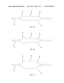 DIRECTIONAL EXPANSION OF INTRALUMINAL DEVICES diagram and image