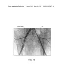 Crush Recoverable Polymer Scaffolds diagram and image