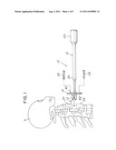 SPINAL IMPLANT CO-INSERTION SYSTEM AND METHOD diagram and image