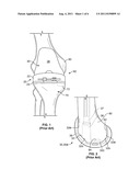 PATIENT-SPECIFIC AUGMENTS diagram and image