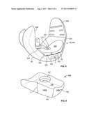 PATIENT-SPECIFIC AUGMENTS diagram and image