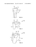 PATIENT-SPECIFIC AUGMENTS diagram and image