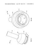 Transdermal Intraosseous Device diagram and image