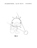 RADIOGRAPHIC IMAGING METHOD AND APPARATUS diagram and image