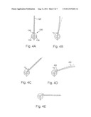 METHOD AND APPARATUS FOR THE PRODUCTION OF A BENT PART diagram and image