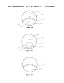 Multifocal Lens Having a Progressive Optical Power Region and     Discontinuity diagram and image