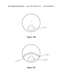 Multifocal Lens Having a Progressive Optical Power Region and     Discontinuity diagram and image